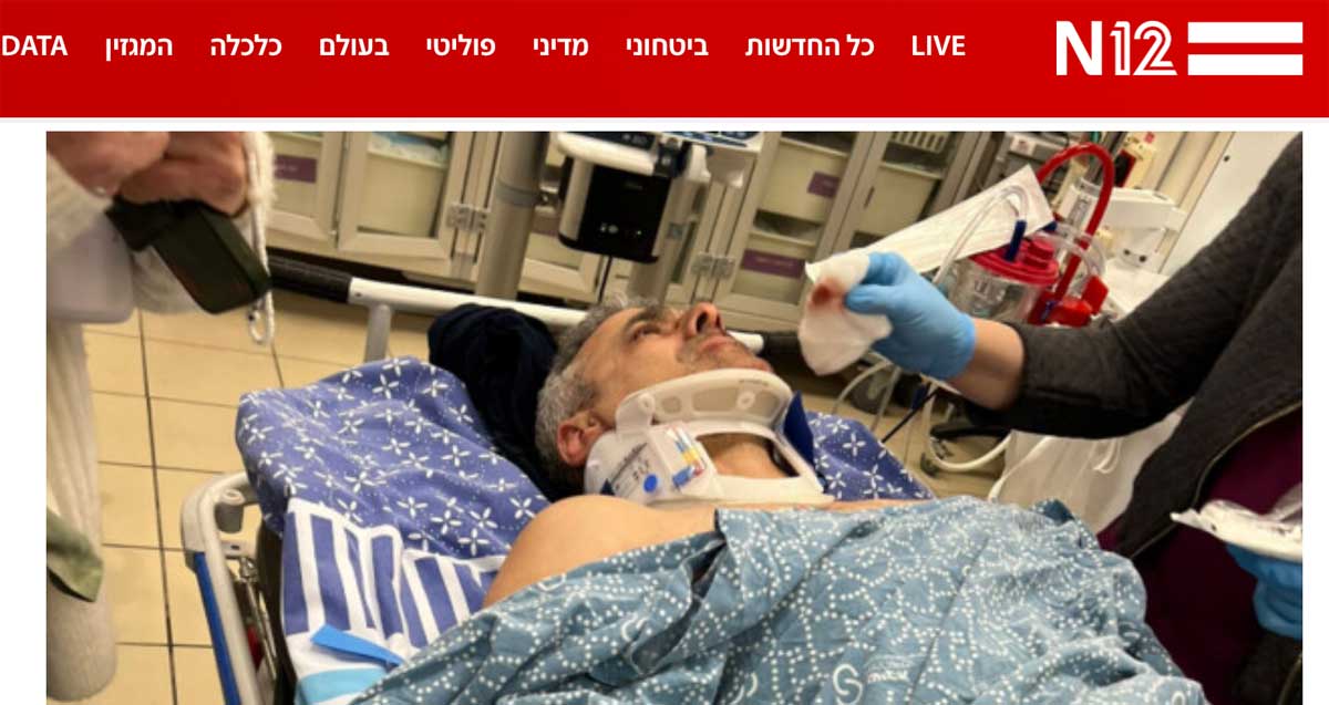רוכב אופניים פצוע בבית חולים לאחר שהותקף על ידי נערים בפארק הלאומי רמת גן